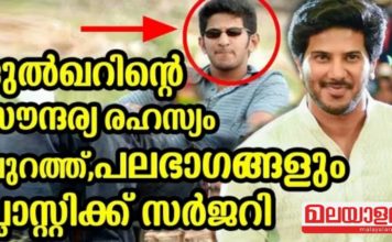 ദുൽഖറിന്റെ സൗന്ദര്യ രഹസ്യം പുറത്ത്, പലഭാഗങ്ങളും പ്ലാസ്റ്റിക്ക് സർജറി