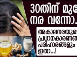 30 വയസ്സിനു മുന്നേ തല നരച്ചൊ; അകാല നരയുടെ കാരണങ്ങളും പരിഹാരങ്ങളും..!!