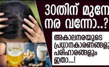 30 വയസ്സിനു മുന്നേ തല നരച്ചൊ; അകാല നരയുടെ കാരണങ്ങളും പരിഹാരങ്ങളും..!!